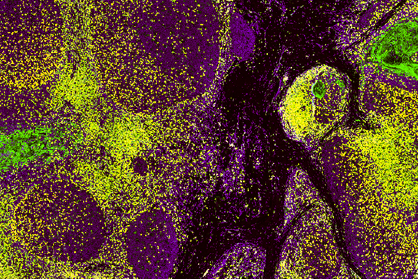 Multiplex immunofluorescence tissue image created with Revolune mIF reagents