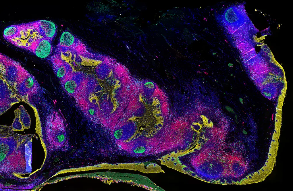 Tonsil tissue stained with Revolune multiplex IF spatial biology panel