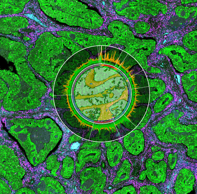 nanostring bruker spatial transcriptomics for recruiment